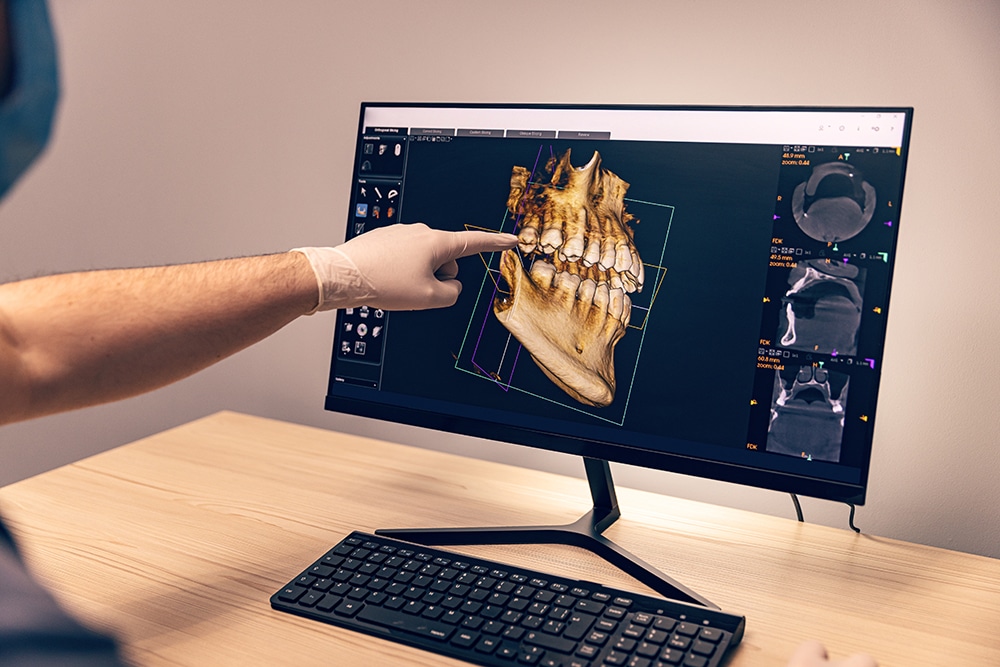 A gloved hand pointing at a 3D dental scan displayed on a computer monitor, showcasing advanced orthodontic technology